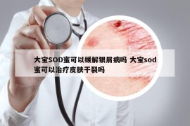 大寶SOD蜜可以緩解銀屑病嗎 大寶sod蜜可以治療皮膚干裂嗎