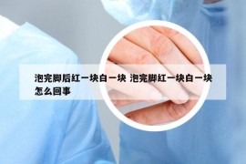 泡完腳后紅一塊白一塊 泡完腳紅一塊白一塊怎么回事