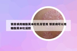 銀屑病用糠酸莫米松乳膏管用 銀屑病可以用糠酸莫米松凝膠
