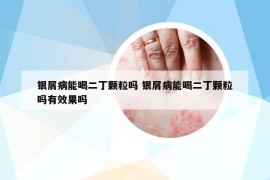 銀屑病能喝二丁顆粒嗎 銀屑病能喝二丁顆粒嗎有效果嗎