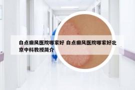 白點(diǎn)癲風(fēng)醫(yī)院哪家好 白點(diǎn)癲風(fēng)醫(yī)院哪家好北京中科教授簡(jiǎn)介