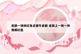 皮膚一塊塊紅有點(diǎn)像牛皮癬 皮膚上一塊一塊像癬紅色