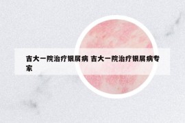 吉大一院治療銀屑病 吉大一院治療銀屑病專家