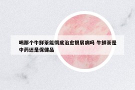喝那個(gè)牛鮮茶能徹底治愈銀屑病嗎 牛鮮茶是中藥還是保健品
