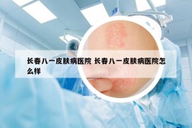 長春八一皮膚病醫(yī)院 長春八一皮膚病醫(yī)院怎么樣