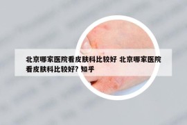 北京哪家醫(yī)院看皮膚科比較好 北京哪家醫(yī)院看皮膚科比較好? 知乎