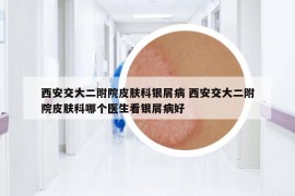 西安交大二附院皮膚科銀屑病 西安交大二附院皮膚科哪個醫(yī)生看銀屑病好