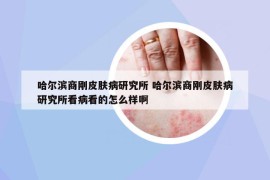 哈爾濱商剛皮膚病研究所 哈爾濱商剛皮膚病研究所看病看的怎么樣啊