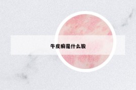 牛皮癬是什么駿