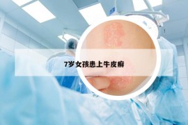 7歲女孩患上牛皮癬