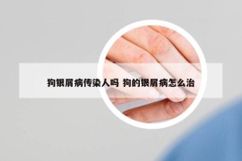 狗銀屑病傳染人嗎 狗的銀屑病怎么治