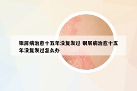 銀屑病治愈十五年沒復(fù)發(fā)過 銀屑病治愈十五年沒復(fù)發(fā)過怎么辦