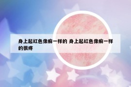 身上起紅色像癬一樣的 身上起紅色像癬一樣的很疼