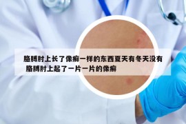 胳膊肘上長(zhǎng)了像癬一樣的東西夏天有冬天沒(méi)有 胳膊肘上起了一片一片的像癬