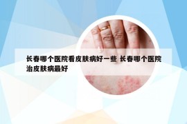 長春哪個醫(yī)院看皮膚病好一些 長春哪個醫(yī)院治皮膚病最好