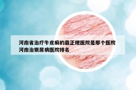 河南省治療牛皮癬的最正規(guī)醫(yī)院是那個(gè)醫(yī)院 河南治銀屑病醫(yī)院排名