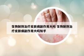 生物制劑治療皮膚病副作用大嗎 生物制劑治療皮膚病副作用大嗎知乎
