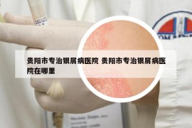 貴陽(yáng)市專治銀屑病醫(yī)院 貴陽(yáng)市專治銀屑病醫(yī)院在哪里