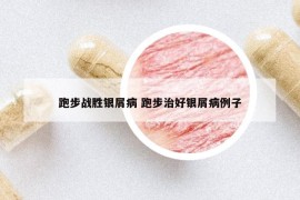 跑步戰(zhàn)勝銀屑病 跑步治好銀屑病例子