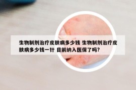 生物制劑治療皮膚病多少錢 生物制劑治療皮膚病多少錢一針 目前納入醫(yī)保了嗎?