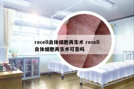 recell自體細(xì)胞再生術(shù) recell自體細(xì)胞再生術(shù)可靠嗎