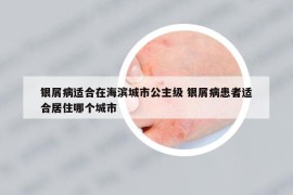 銀屑病適合在海濱城市公主級 銀屑病患者適合居住哪個城市