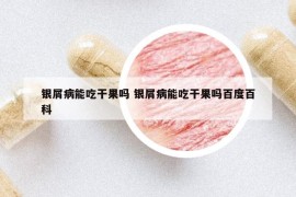 銀屑病能吃干果嗎 銀屑病能吃干果嗎百度百科