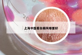 上海中醫(yī)看白癜風(fēng)哪里好