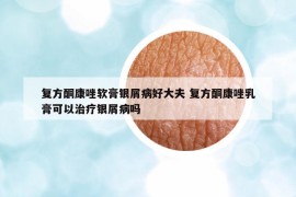 復(fù)方酮康唑軟膏銀屑病好大夫 復(fù)方酮康唑乳膏可以治療銀屑病嗎