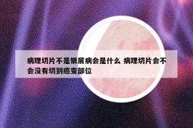 病理切片不是銀屑病會(huì)是什么 病理切片會(huì)不會(huì)沒(méi)有切到癌變部位