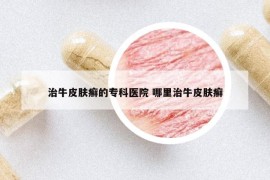 治牛皮膚癬的?？漆t(yī)院 哪里治牛皮膚癬