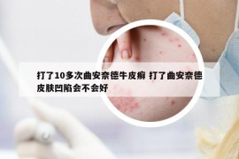 打了10多次曲安奈德牛皮癬 打了曲安奈德皮膚凹陷會(huì)不會(huì)好