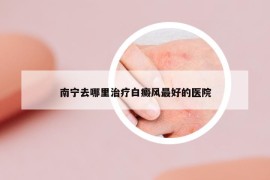 南寧去哪里治療白癜風(fēng)最好的醫(yī)院