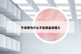 牛皮癬為什么不能做晶體植入