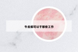 牛皮癬可以干那些工作
