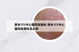 新鄉(xiāng)371中心醫(yī)院皮膚科 新鄉(xiāng)371中心醫(yī)院皮膚科怎么樣