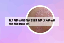 復方黃柏祛癬搽劑南京哪里有買 復方黃柏祛癬搽劑能治銀屑病嗎