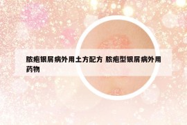 膿皰銀屑病外用土方配方 膿皰型銀屑病外用藥物
