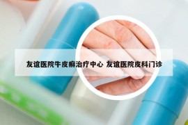 友誼醫(yī)院牛皮癬治療中心 友誼醫(yī)院皮科門診