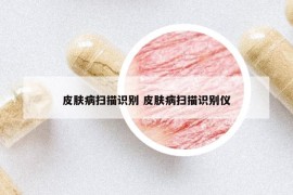 皮膚病掃描識(shí)別 皮膚病掃描識(shí)別儀