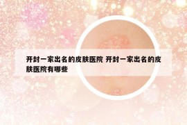 開封一家出名的皮膚醫(yī)院 開封一家出名的皮膚醫(yī)院有哪些