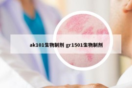 ak101生物制劑 gr1501生物制劑