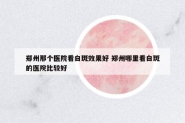 鄭州那個醫(yī)院看白斑效果好 鄭州哪里看白斑的醫(yī)院比較好