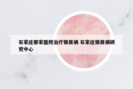 石家莊那家醫(yī)院治療銀屑病 石家莊銀屑病研究中心