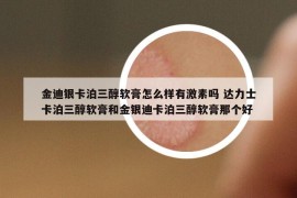 金迪銀卡泊三醇軟膏怎么樣有激素嗎 達(dá)力士卡泊三醇軟膏和金銀迪卡泊三醇軟膏那個好