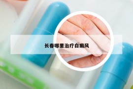 長春哪里治療白癜風