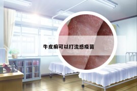 牛皮癬可以打流感疫苗