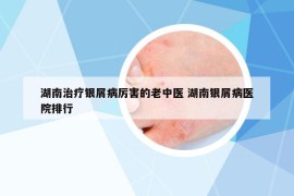 湖南治療銀屑病厲害的老中醫(yī) 湖南銀屑病醫(yī)院排行