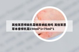 英格萊恩樟腦乳霜銀屑病能用嗎 英格萊恩 草本香樟乳霜150ml*1+75ml*1