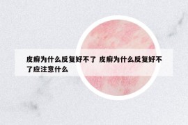 皮癬為什么反復(fù)好不了 皮癬為什么反復(fù)好不了應(yīng)注意什么